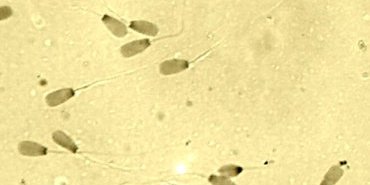 spermato1